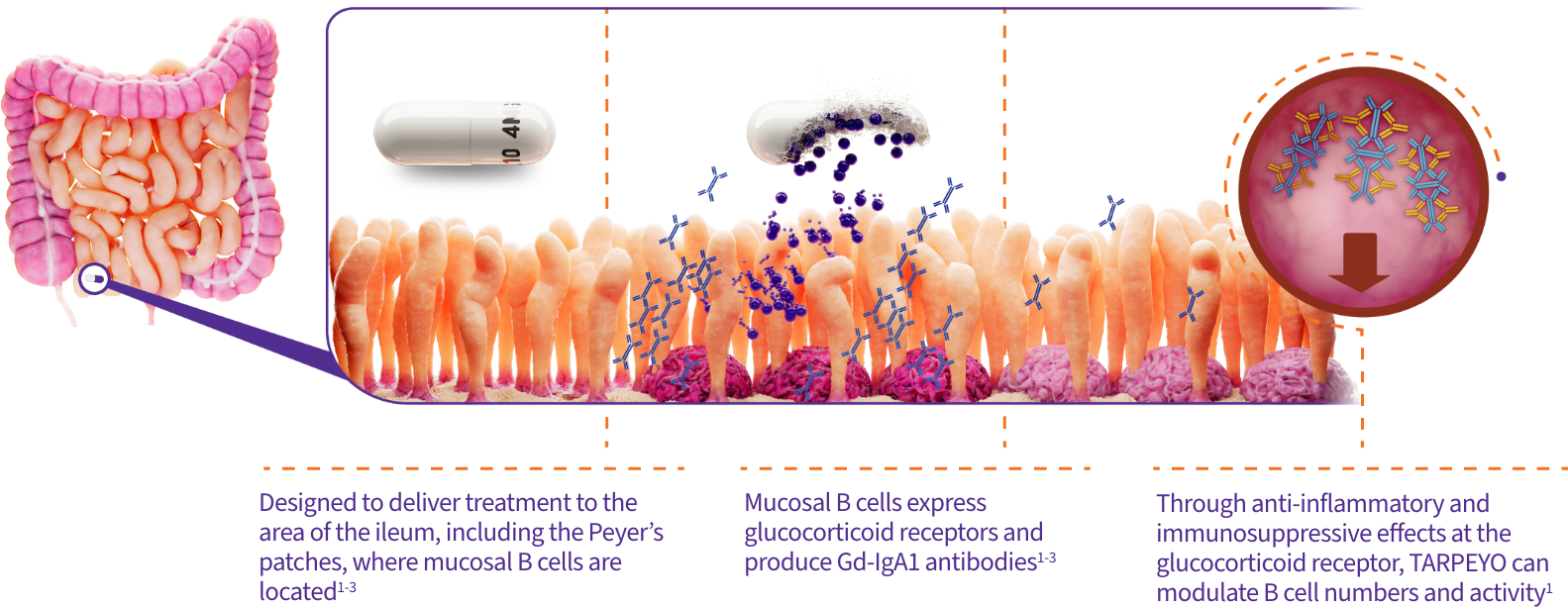 An illustration of how TARPEYO is designed to deliver treatment to the gut