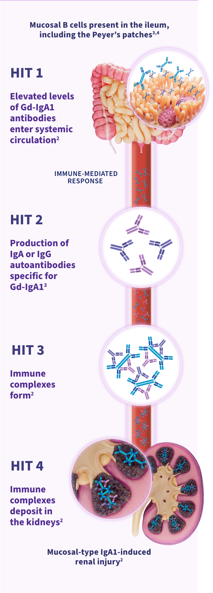 A graphic illustrating TARPEYO’s mechanism of action in four key steps (HITs):
HIT 1: Mucosal B cells present in the ileum, including the Peyer's patches, are depicted. Increased IgA1 production leads to intestinal injury.
HIT 2: Elevated levels of Gd-IgA1 antibodies enter systemic circulation. B cells are primed to produce Gd-IgA1.
HIT 3: Production of IgA or IgG autoantibodies specific for Gd-IgA1 leads to the formation of immune complexes.
HIT 4: Immune complexes deposit in the kidneys, resulting in kidney damage.
Each HIT is highlighted with detailed visuals and annotations, showing the progression from mucosal B cells to kidney damage through the formation and deposition of immune complexes.