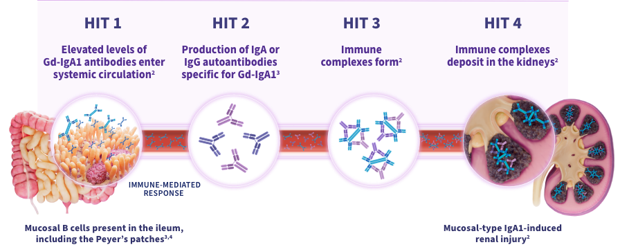 A graphic illustrating TARPEYO’s mechanism of action in four key steps (HITs):
HIT 1: Mucosal B cells present in the ileum, including the Peyer's patches, are depicted. Increased IgA1 production leads to intestinal injury.
HIT 2: Elevated levels of Gd-IgA1 antibodies enter systemic circulation. B cells are primed to produce Gd-IgA1.
HIT 3: Production of IgA or IgG autoantibodies specific for Gd-IgA1 leads to the formation of immune complexes.
HIT 4: Immune complexes deposit in the kidneys, resulting in kidney damage.
Each HIT is highlighted with detailed visuals and annotations, showing the progression from mucosal B cells to kidney damage through the formation and deposition of immune complexes.